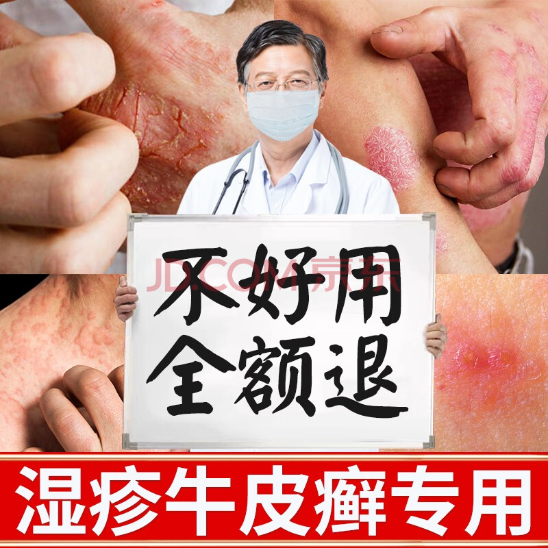 伊乃爾溼疹膏成人止癢膏頑固腳氣真菌感染肛門肛周皮膚瘙癢外用 重度