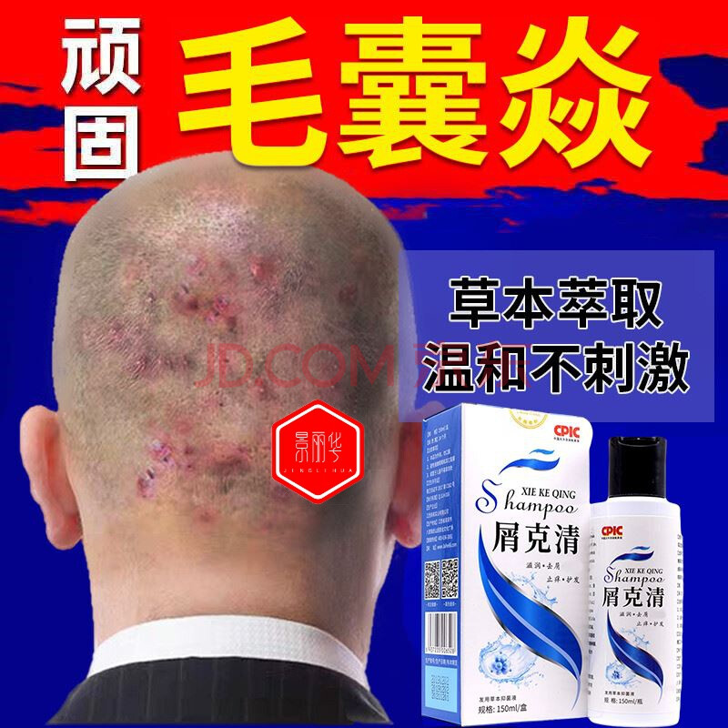 仁邦达 抑菌洗剂洗剂阿灵仁邦达贝杨发液场头皮屑洗