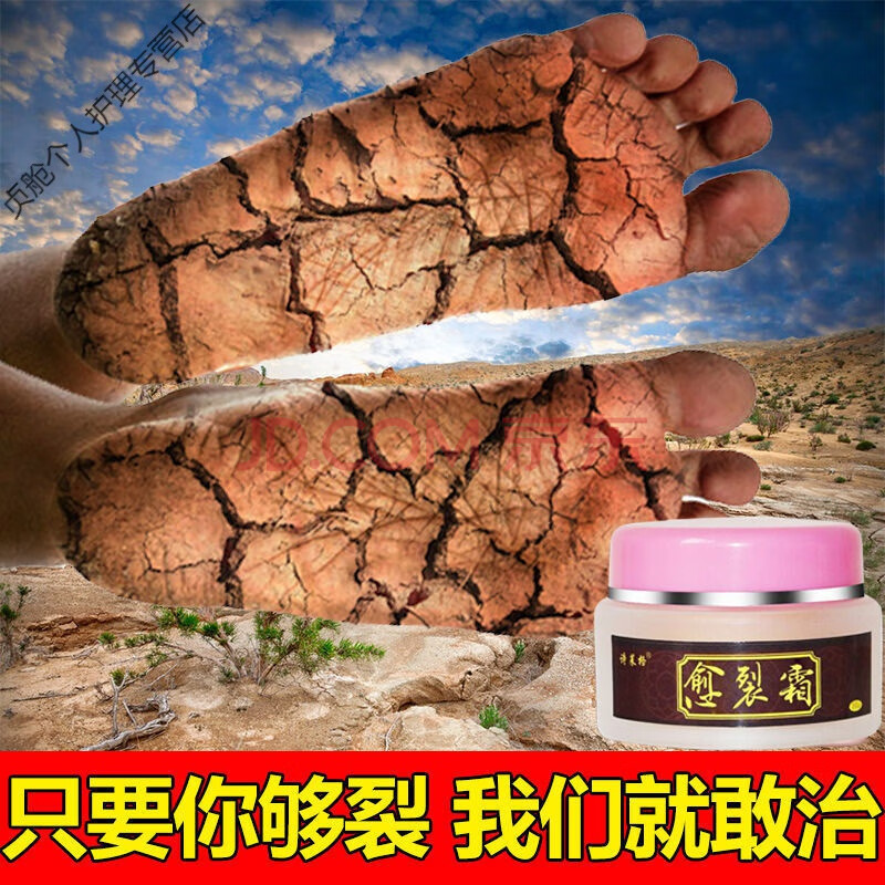 【专治干裂 效果好】手足裂口脚后跟干裂皲裂膏防裂防冻l疮护手霜