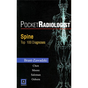 袖珍放射专家:脊椎的100个主要诊断(英文版)