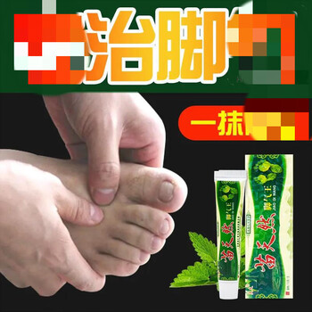 苗天然脚气王痔i疮膏脚l气王快速去l脚气脚臭糜烂水泡防止复发 一支