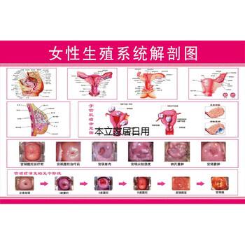 女性生殖器解剖图 医院宣传挂图子宫 妇科海报宫颈疾病示意图 女性