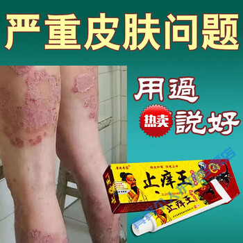 神农百草膏止痒膏慢性湿l疹皮l炎皮肤瘙痒大腿内侧瘙痒肛门外阴囊瘙痒