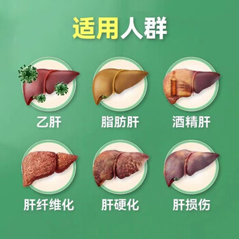 龙牙肝泰胶囊8粒/盒保肝适用于急慢性肝炎转氨酶偏高辅助治疗 2盒巩固