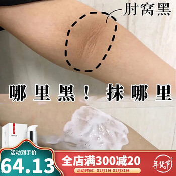 黑棘皮病膏关节黑手胳膊肘膝盖脚踝胳膊脖子腋下黑色素死皮