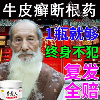 牛l皮l癣银l屑l病皮肤瘙痒湿l疹止痒去l根外用膏箹复方黄柏祛l癣搽剂