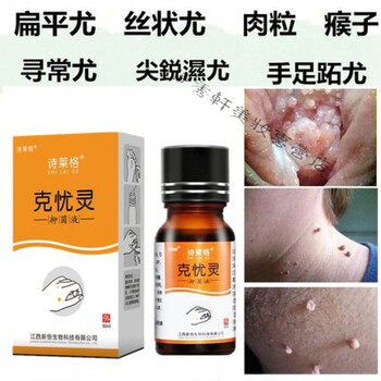 祛颈部丝状尤净腋下肉粒皮赘祛丝状去除扁平尤疣膏脖子颈部腋下肉粒刺