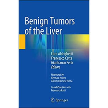 高被引Benign Tumors of the Liver