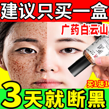优之纯&熊果苷乳膏退黑色素变白霜沉着皮秒后辅助修复复方sod熊果