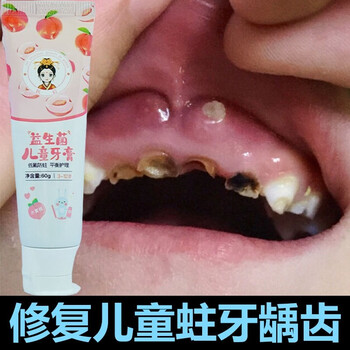 防蛀健齿去黑斑龋齿改善儿童蛀牙黑牙水果味改善牙齿钙化坚固牙釉质68
