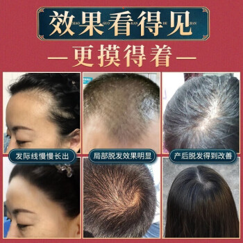 同仁堂生姜洗发水防脱育发洗发水脱发控油草本老姜王护发洗头水400ml