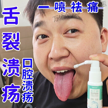 舌炎舌咽神经痛舌头溃疡反复口腔溃疡舌头局部疼痛麻木灼痛舌尖红1