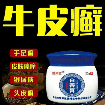百善膏银i屑病牛皮1癣皮肤专用湿1疹皮1焱头皮1癣体1癣手足1癣荨麻1疹