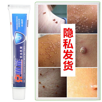 疣克舒软膏去面部扁平脸部疣脖子丝状优手足去除寻常尤去除膏跖尤净