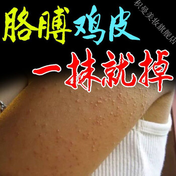 皮肤有鸡皮疙瘩吃什么好(皮肤有鸡皮疙瘩吃什么好得快)