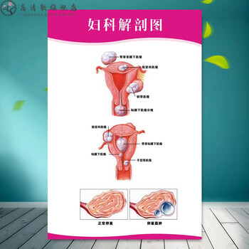 【优选品质】女性生殖器官图 女性泌尿生殖解剖宫颈疾病示意图妇科