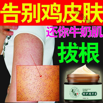 鸡皮疙瘩有好吃么的简单介绍