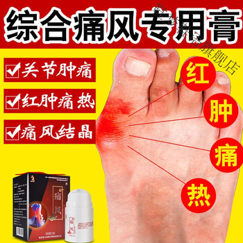 痛风膏痛风石结晶大脚趾肿胀手指关节疼痛酸麻肿痛风膏一抹灵 单品