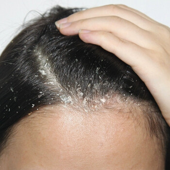 九素 洗发水洗头发去油止痒洗发露洗发乳洗头水男女士用去大块头皮屑