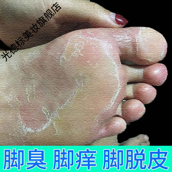 脚气止痒克星祛l脚臭汗脚烂l脚丫脱皮水泡深层止痒脚气膏1盒