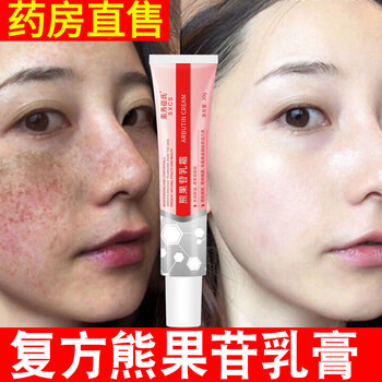 熊果苷凝胶 复方sod熊果苷乳膏和烟酰胺凝胶熊果甙软膏官方店旗舰 买