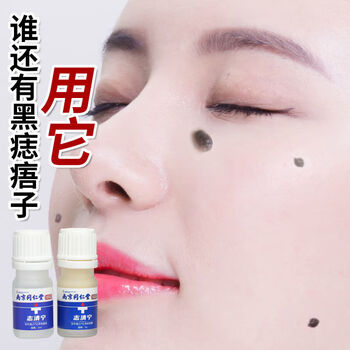 官方直售膏不留疤无痕无痛去痣克疣膏脸部除黑痣去疣膏点痣膏祛痣粒疙