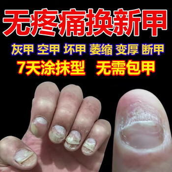 南京同仁堂南京灰指甲液去除专用脚趾甲本灵灰甲净非特i效中草药 三