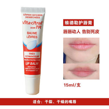 哪种护唇膏好(什么护唇膏好用又便宜)
