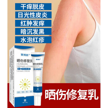 适之晒伤修复 男士皮肤晒伤修复膏男士儿童日光性紫外线过敏红肿蜕皮