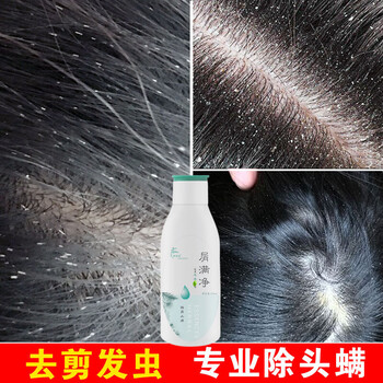 去卷发虫除吃发虫儿童去屑止痒断发抗真菌除螨虫剪发虫洗发水 440ml