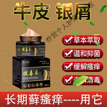 牛1皮1癣专用膏皮肤瘙痒皮1焱癣股1藓头皮1癣顽固性湿1疹无止痒王5瓶