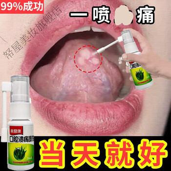 口腔溃疡细菌感染口舌生疮异味肿痛舌头起泡上火烂嘴喷剂买三二适合