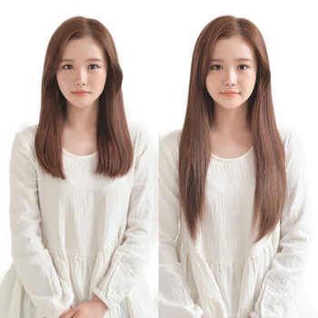 大面积脱发别慌！植发不是唯一解 纹发凭11大优势成脱发星人新宠