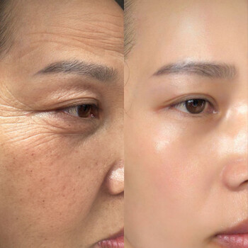 眼贴膜去细纹紧致抗皱眼纹消祛鱼尾纹角眼膜贴补水眼袋黑眼圈