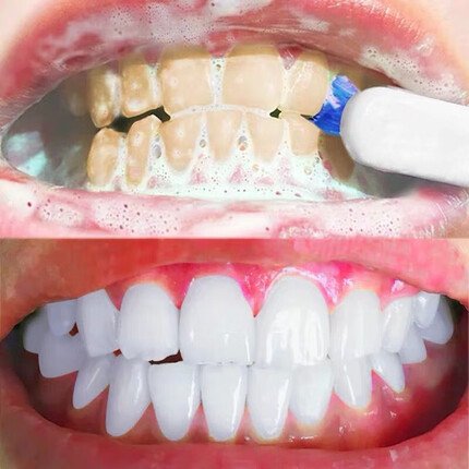 买二送一洗牙粉牙白器神1盒装