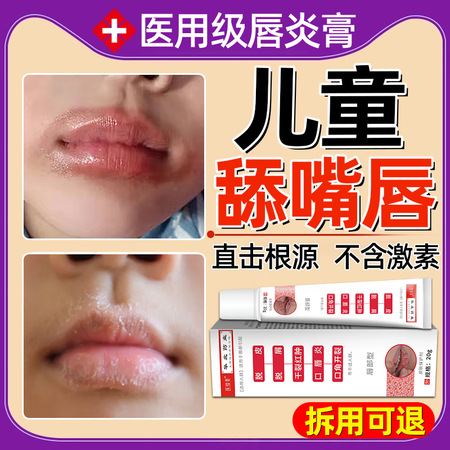 嘴巴上火可以涂唇膏吗(嘴巴上火了怎么办才能好得快)