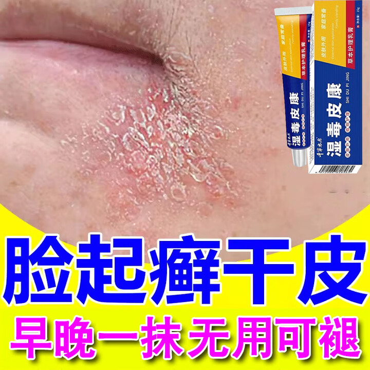 皮肤干燥起皮脸上长癣 脸部过敏红痒起皮脱屑 下巴额头长疙瘩发红 1