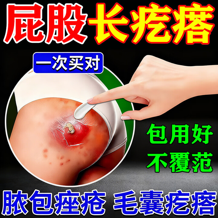 千草本原屁股痒起疙瘩坐板疮硬块闷头屁股上有久坐湿痒疹长痘痘脓包火疖子 买二送一【90%顾客选择】发三盒【图片 价格 品牌 报价】-京东