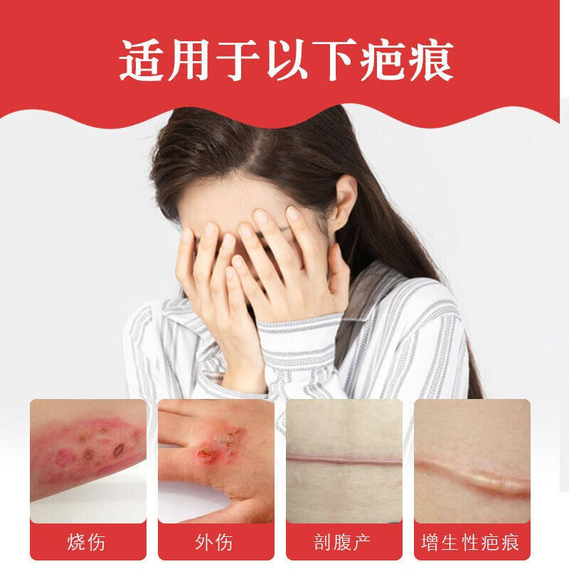 仁和硅酮疤痕凝胶15g支辅助改善疤痕手术烧烫伤凹凸疤新老包装交替