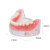 动力瓦特 牙齿模型 口腔教学牙齿摆件 病理牙蛀牙龋齿教具 牙齿解剖模型 4颗钉半口种植模型 