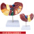 山顶松 彩色肝脏模型 常见临床病理特征 病理肝脏模型 医患沟通硬化脂肪炎肝胆内科教学