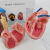 人体正常内脏烟病变器官对比心肺部膀胱血管口腔气管胎模型 心脏对比 病理与正常比较