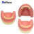 TWTCKYUS上颌窦提升操练模型 种植牙练习模型 口腔种植 软牙龈 齿科材料 下颌骨种植模型小号1个