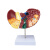 山顶松 彩色肝脏模型 常见临床病理特征 病理肝脏模型 医患沟通硬化脂肪炎肝胆内科教学