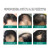 章光101（ZHANGGUANG101）瑞丝育发液改善男女脱头发际线上移稀疏秃顶 减少掉发固发洗发水 防掉发精华液80ml