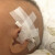 3M胶带敏感肌肤专用胶布1534-1宝宝婴儿童透气低敏纸胶 1534-0(24卷)1盒