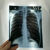 胶片喷墨蓝片干式CT DR CR 牙科X光片放射科打印胶片 8*10