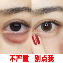 红参蜗牛多肽眼霜淡化黑眼圈淡化细纹脂肪粒眼袋男女提拉紧致补水保湿眼部精华比芭美 2瓶周期装【第二瓶五折】
