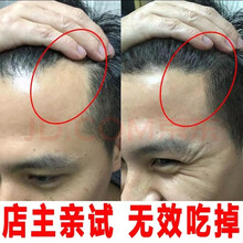 九叶草生姜洗发水男女增发密发强根健发护发脂溢性脱发老姜王姜汁洗发水 两瓶装