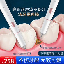 家用牙结石去除器洁牙器速效溶解洗牙齿污垢除牙石超声波洁牙器洁牙仪洗牙器电动神器 洁白款+口气清新喷雾